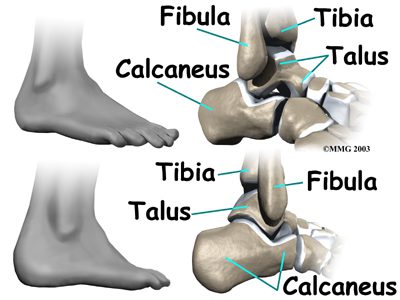 Psoriatic Arthritis