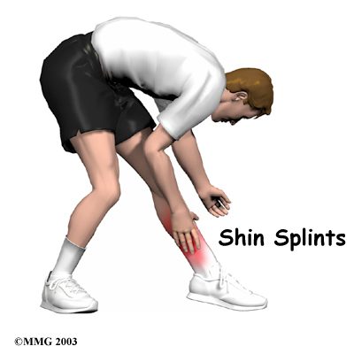 leg_shinsplints_intro01